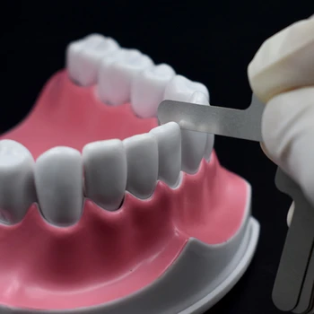 Nové Ústne Zubné Interproximal Meracie Pravítka Opatrenie Zub Medzera Nehrdzavejúcej Ocele Vratné práv duševného vlastníctva Systém Ortodontická Liečba
